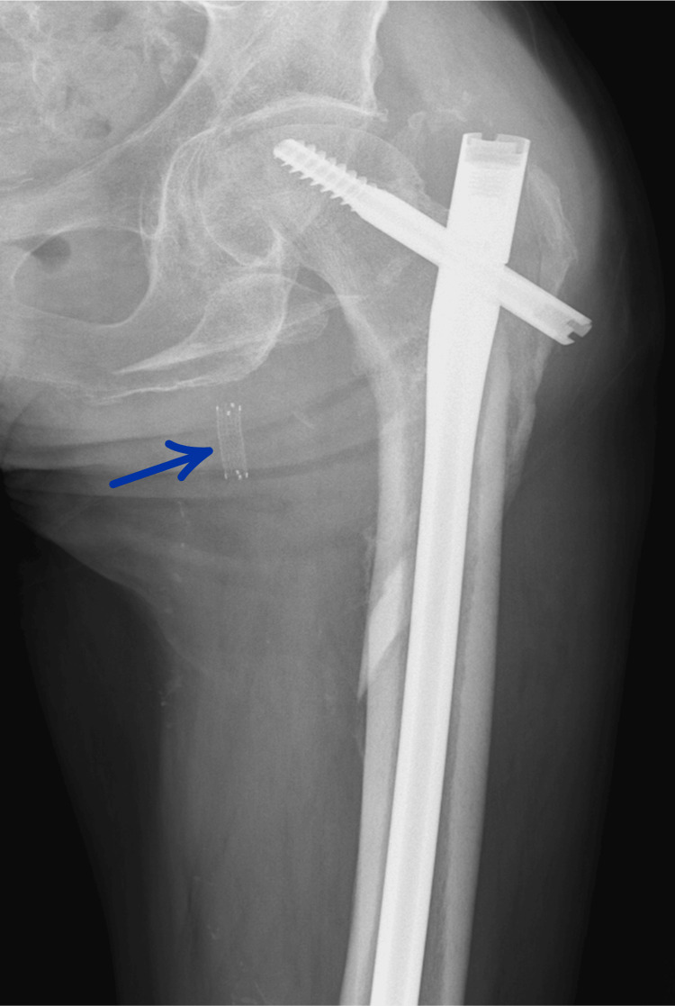 Figure 7