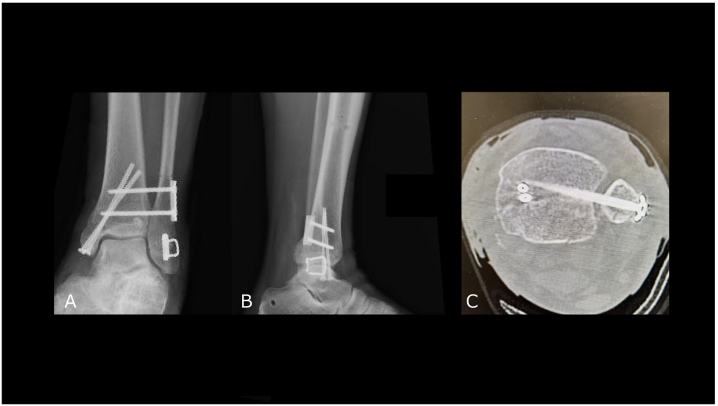 Figure 4