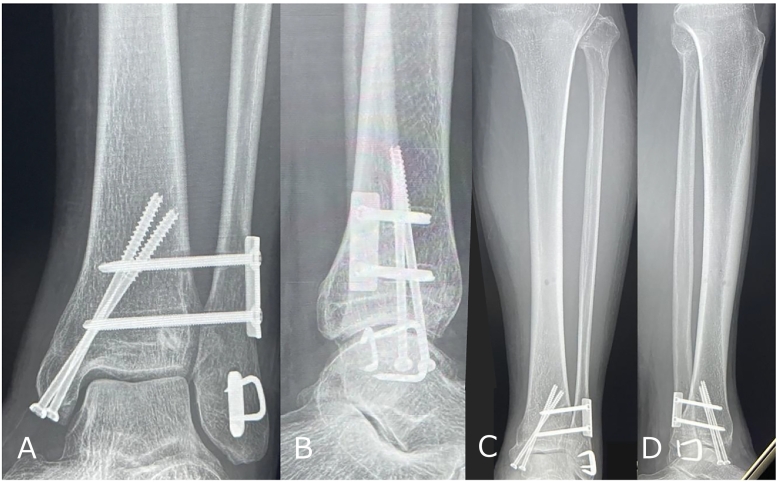 Figure 5