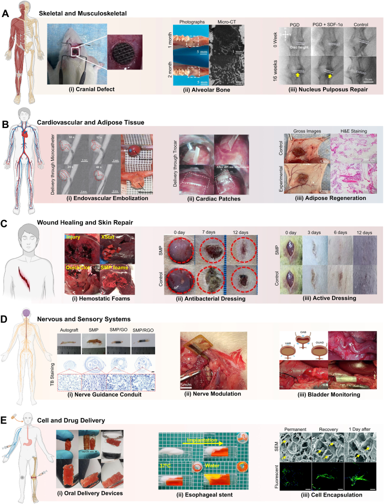 Figure 14