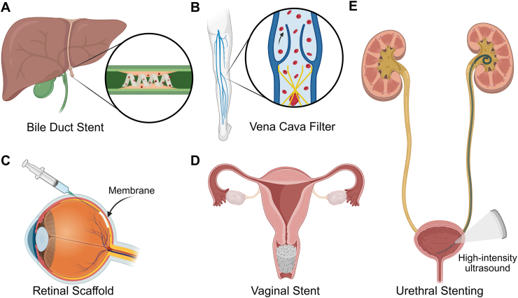 Figure 15