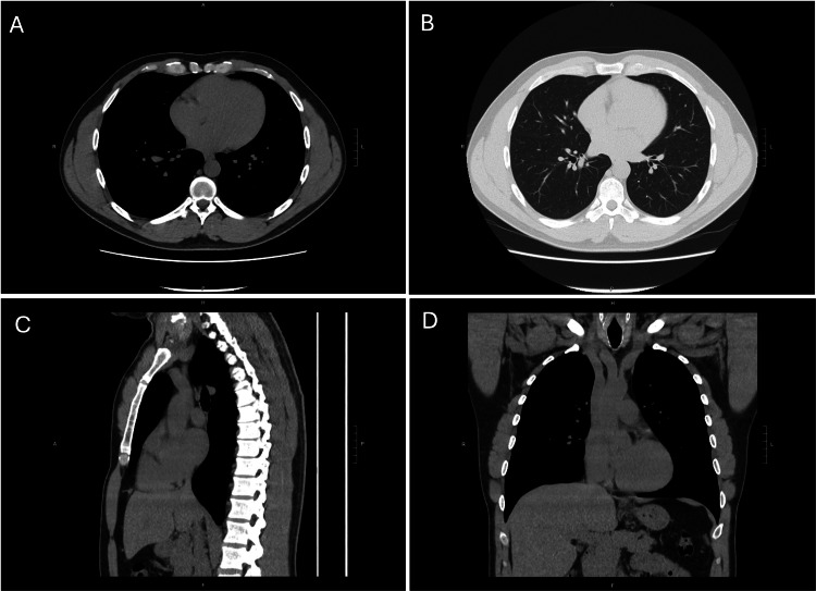Figure 12