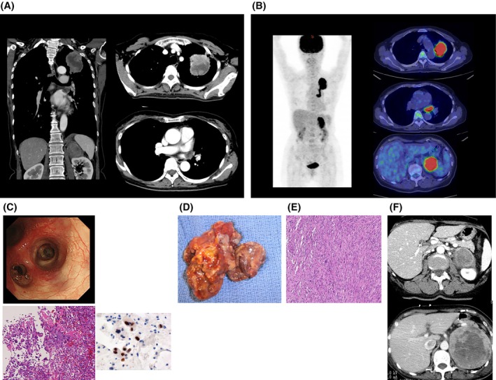 FIGURE 2