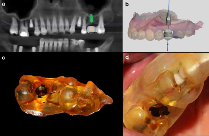 FIGURE 1
