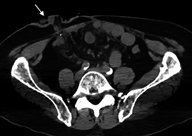 Figure 5