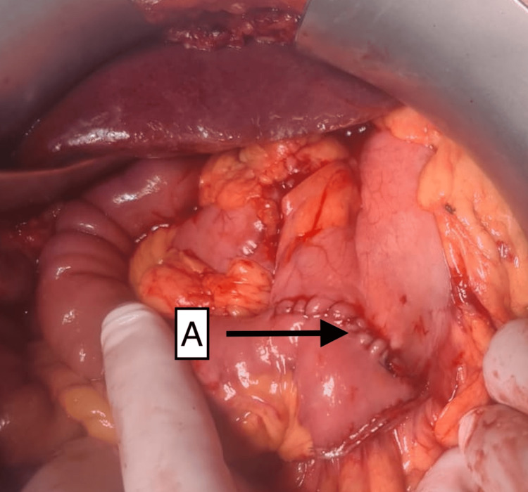 Figure 5