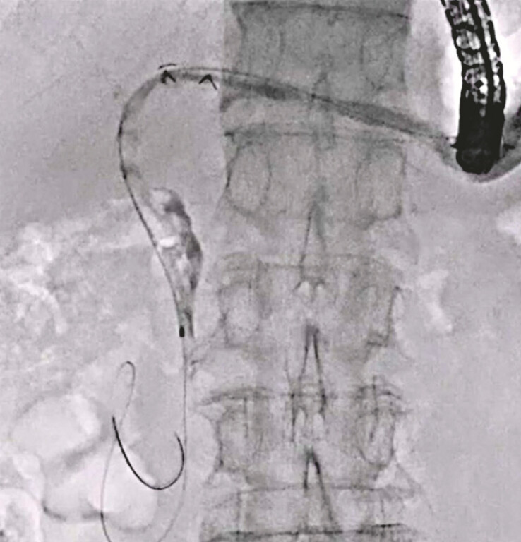Fig. 2