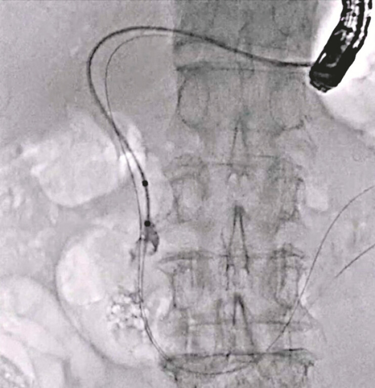 Fig. 5