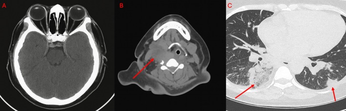 FIGURE 2