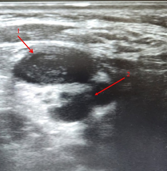 FIGURE 1