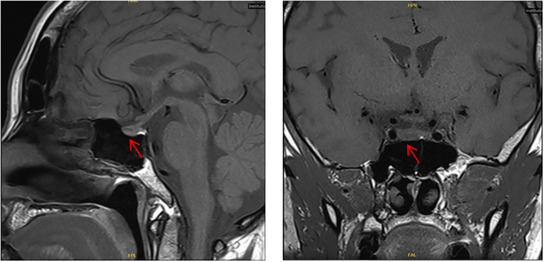 Figure 3