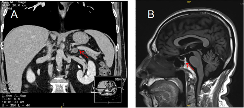 Figure 4