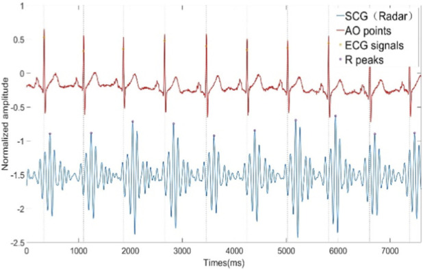 FIGURE 4