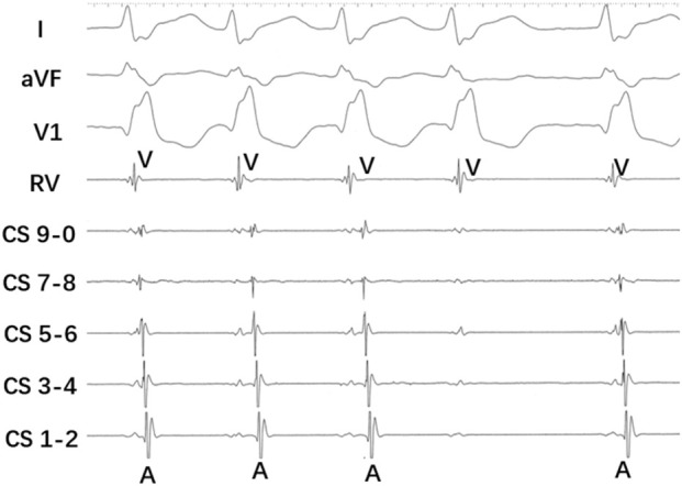 FIGURE 2