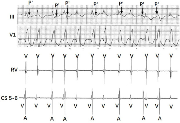 FIGURE 3