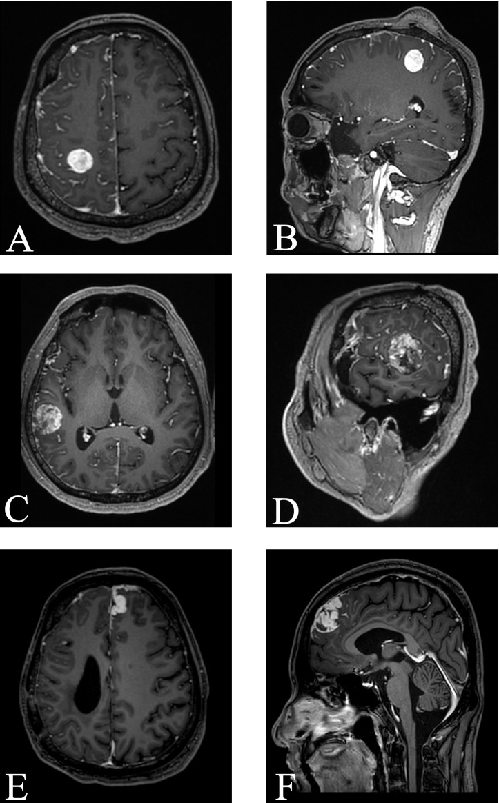 Figure 1