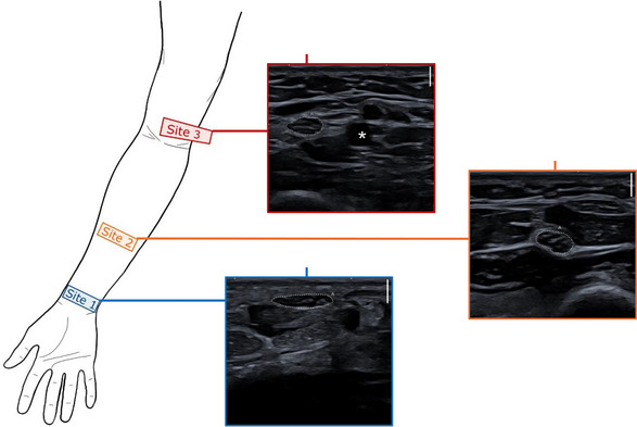 FIGURE 1