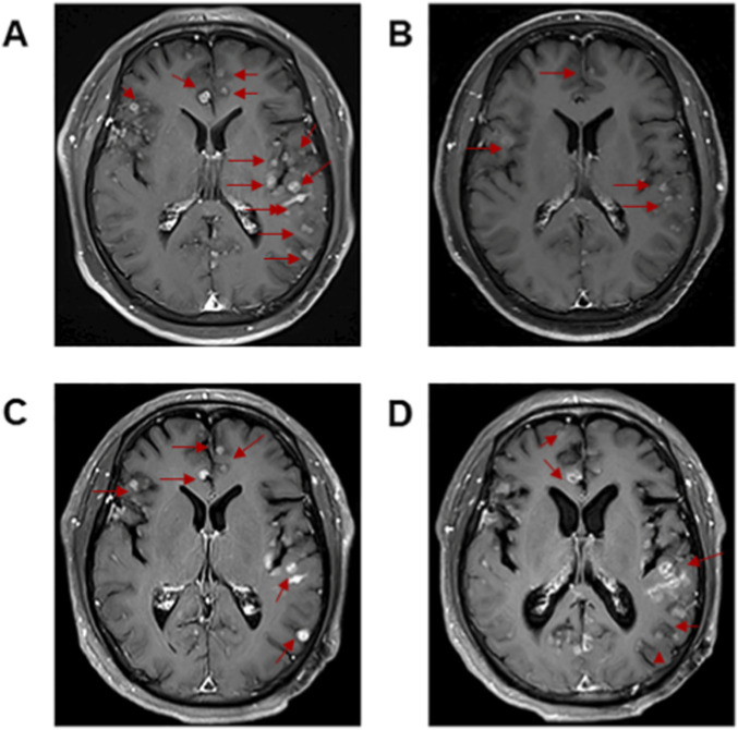 FIGURE 3