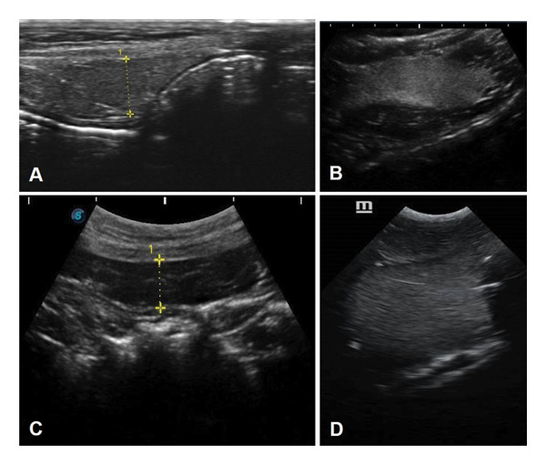 FIGURE 3