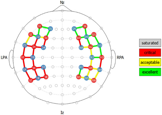 FIGURE 4
