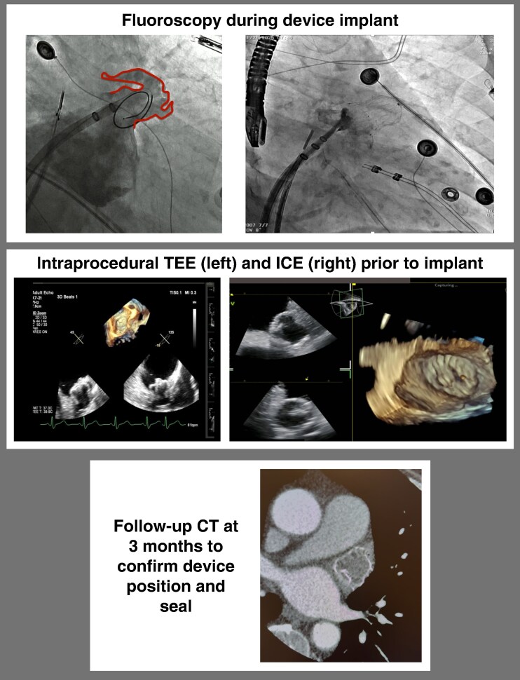 Figure 3