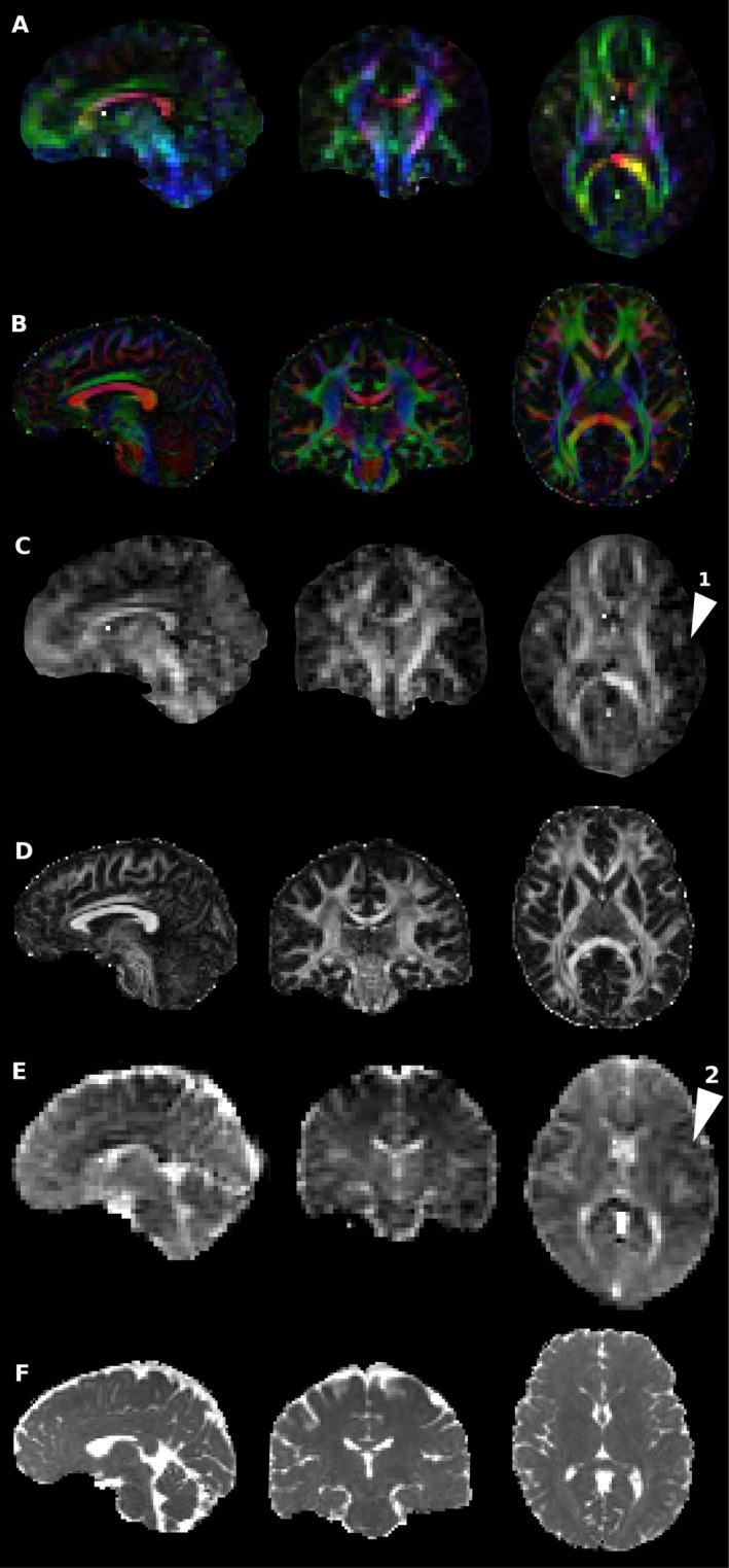 FIGURE 2
