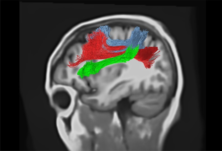 FIGURE 7