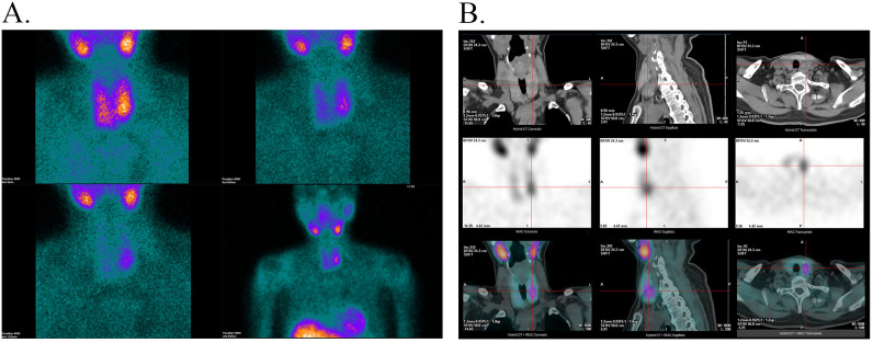 Figure 2