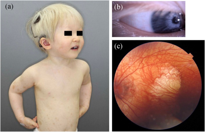 FIGURE 3