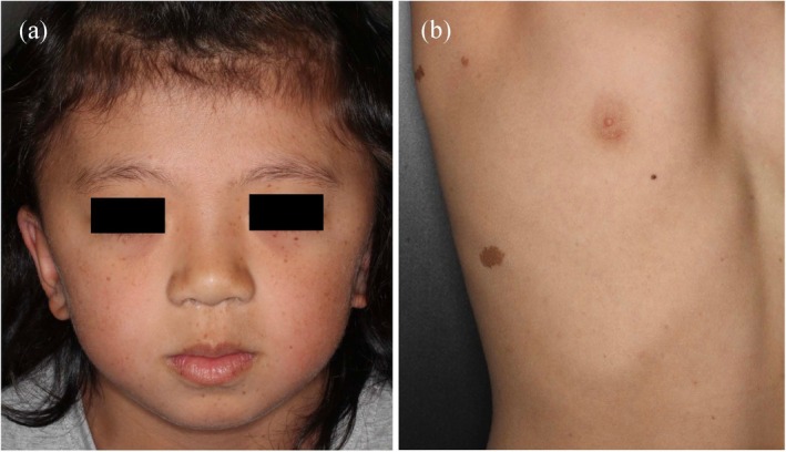 FIGURE 6