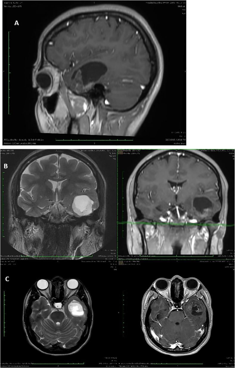 Figure 1