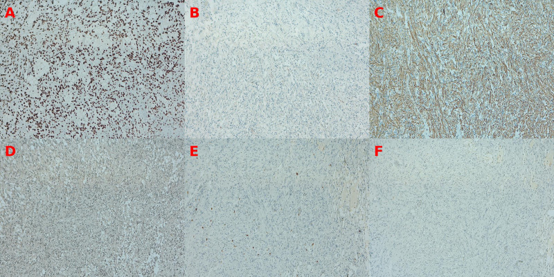Figure 2
