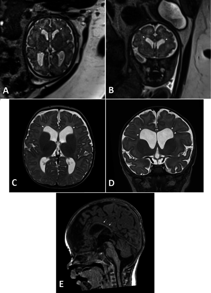 FIGURE 2