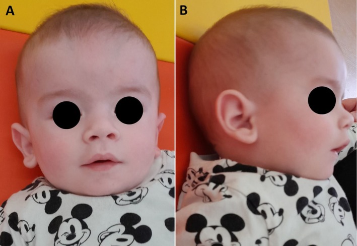FIGURE 3