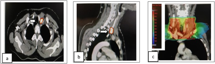 FIGURE 1