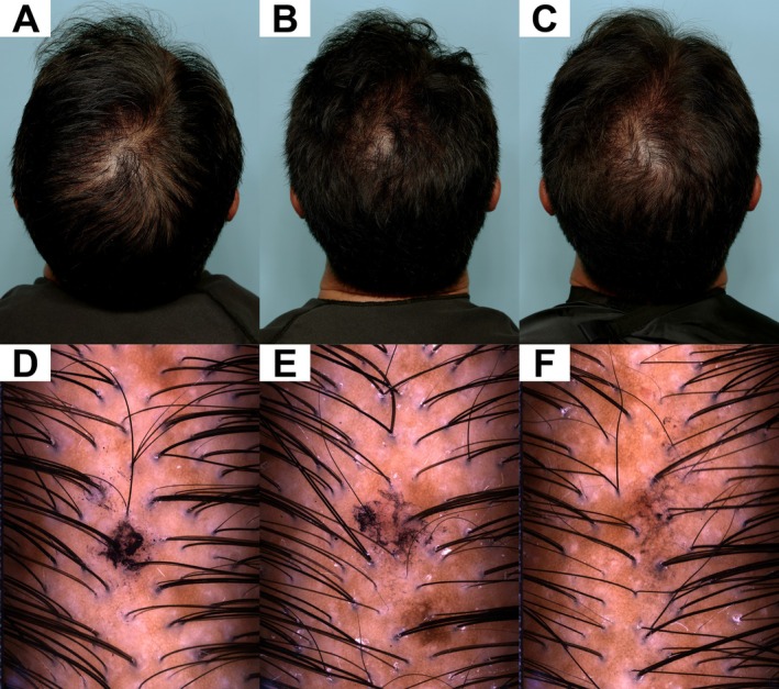 FIGURE 2