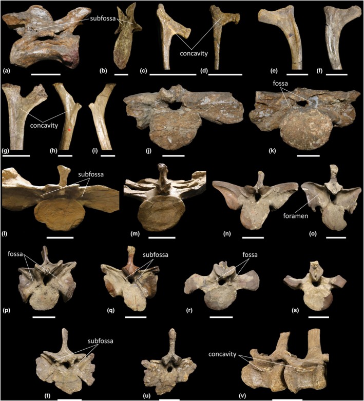 FIGURE 11