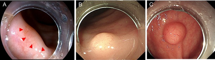 FIGURE 1