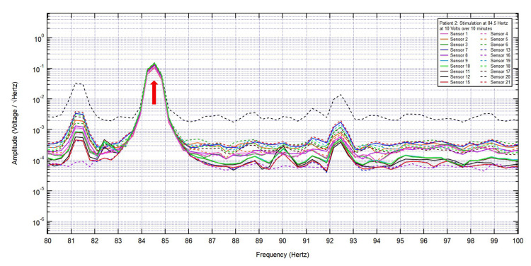 Figure 7