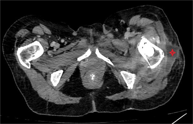 Figure 6