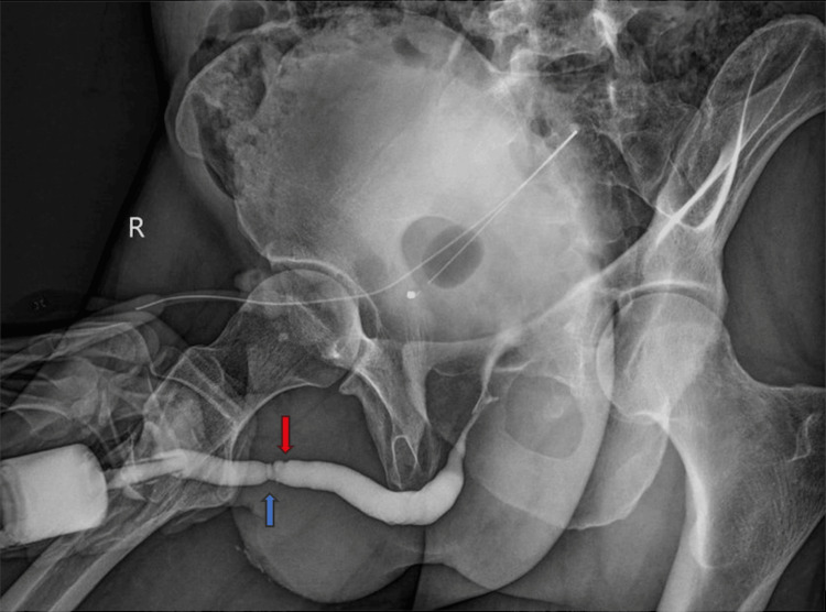 Figure 5
