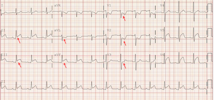 Figure 10