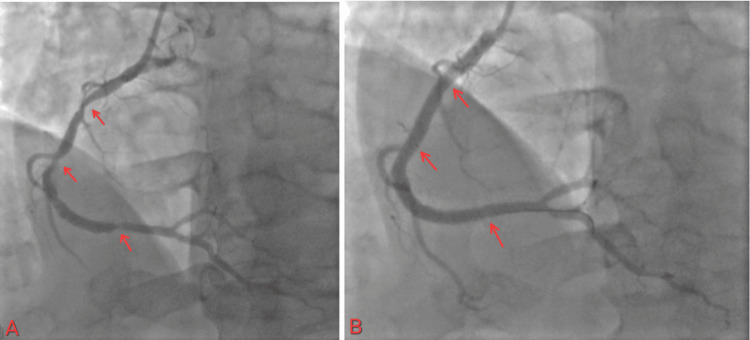 Figure 12