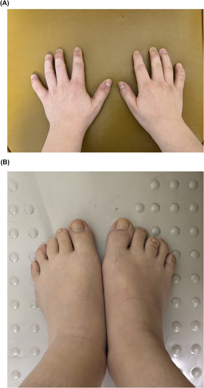 FIGURE 2