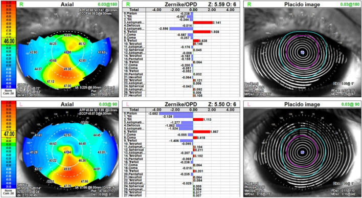 FIGURE 3