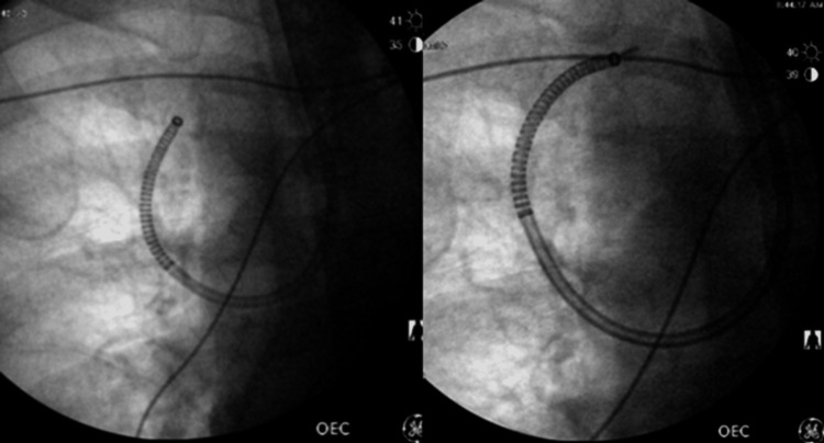 Figure 12