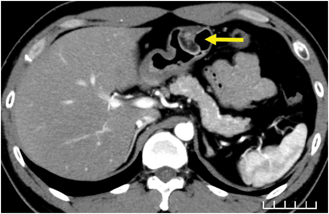 Fig. 2
