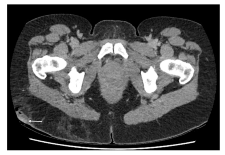 Figure 10