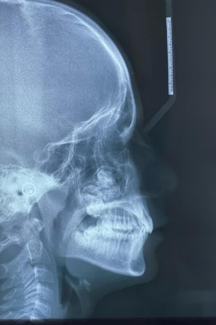 FIGURE 1