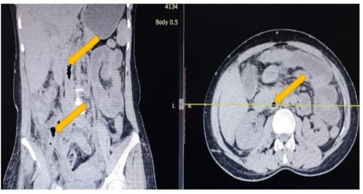 FIGURE 1